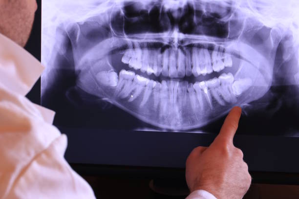 Best Emergency Treatment for Jaw Pain or Injury in Kings Beach, CA