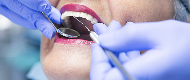 Best Broken or Chipped Tooth Repair in Kings Beach, CA